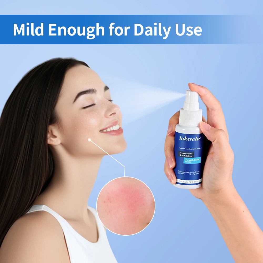 Hypochlorous Acid Facial Spray for Acne and Skin Soothing