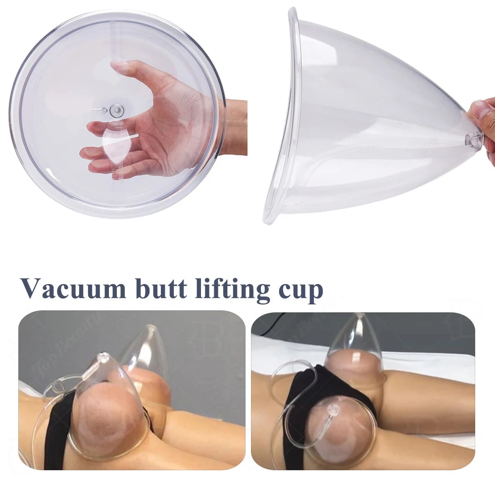Vacuum Massage Cups for Breast and Buttock Lifting